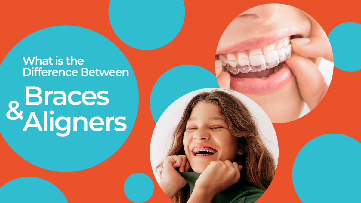 Little girl smiling with braces and someone putting on an aligner with text "What is the Difference Between Braces & Aligners" 