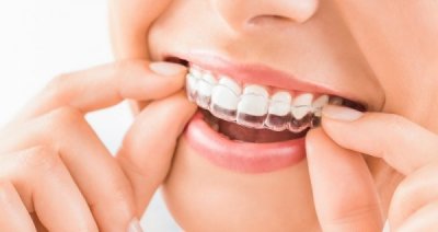 Woman putting on a clear retainer 
